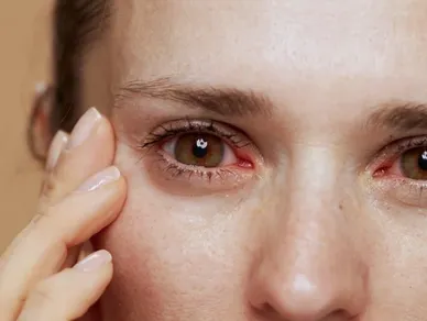 Dry eye disease illustration