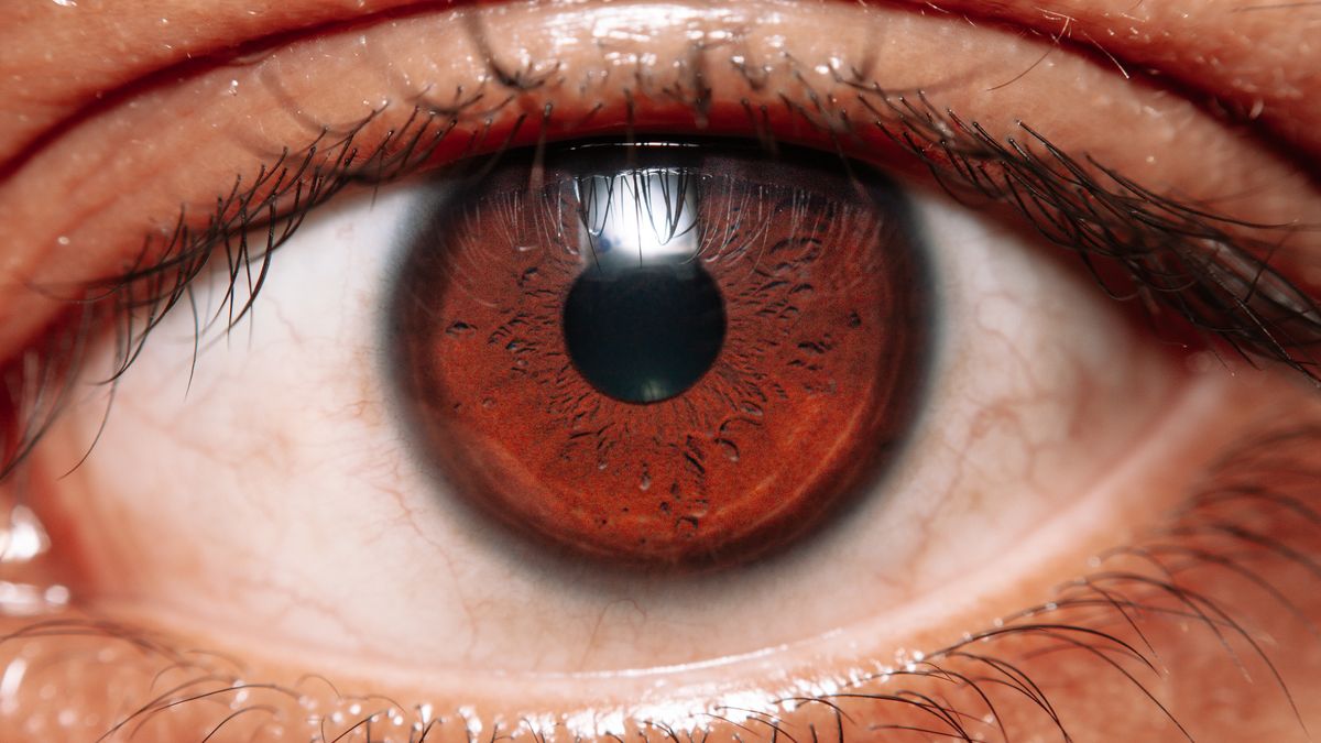 Close-up of a red, irritated eye