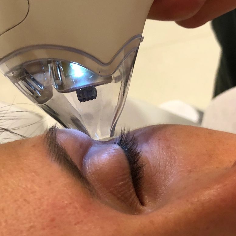 Therapie beim Augenarzt