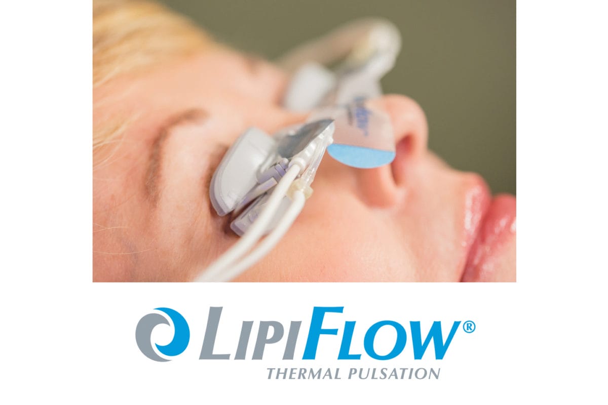LipiFlow: automatisierte Wärmebehandlung der Meibom-Drüsen