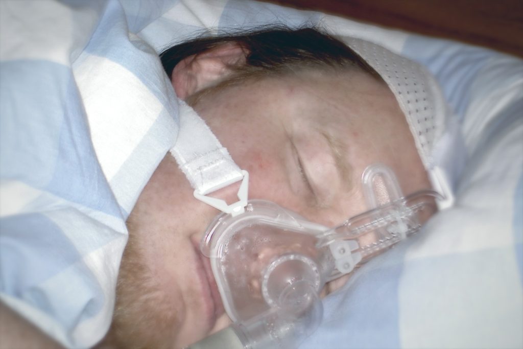 Mann schläft mit einer CPAP-Nasenmaske; der Luftstrom kann über Nacht die Augen austrocknen