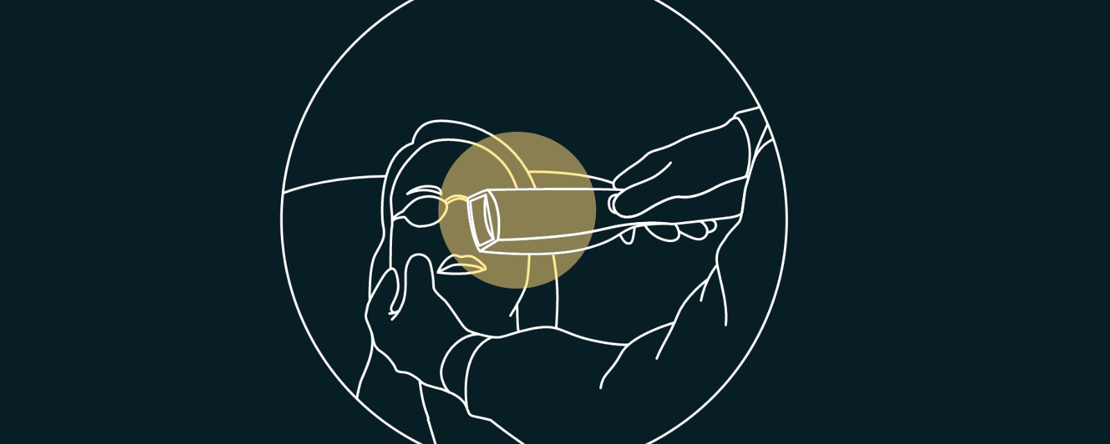 Schema der IPL-Anwendung auf der Haut unter dem Auge mit lichtdichten Augenschalen