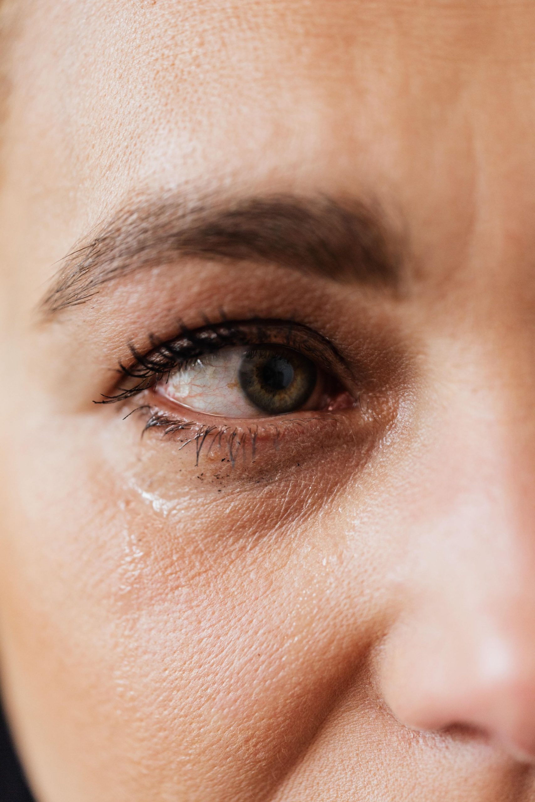 Dry eye disease illustration